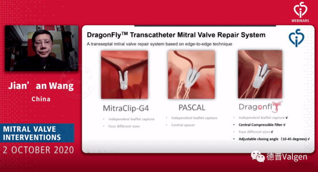 前沿技术 | 国内首款经股静脉二尖瓣瓣膜夹DragonFly?正式进入注册临床研究阶段